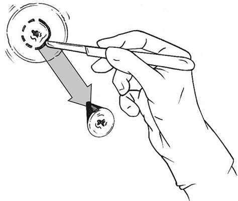 Cold Knife Conization
