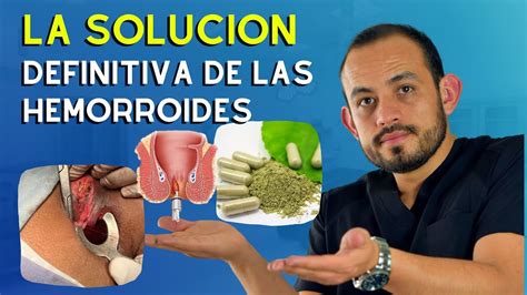 Como Es Un Hemorroide