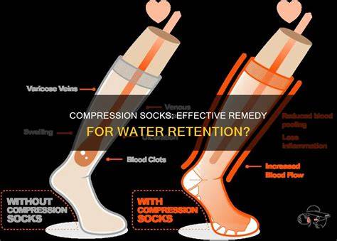Compression Stockings For Water Retention