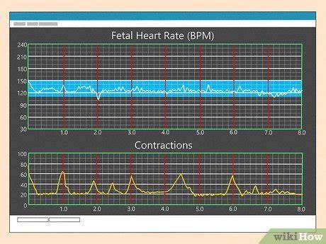 Contractions On Monitor