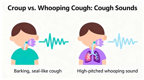 Croup Vs Whooping Cough