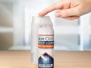 Cryogenic Skin Tag