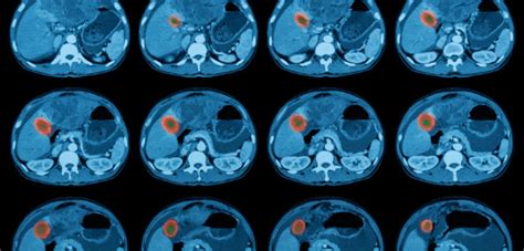 Ct Scan How Long Results