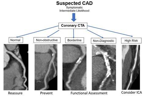 Cta Medical Abbreviation