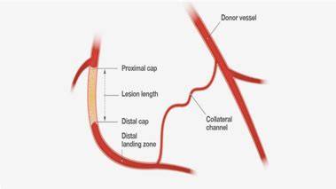 Cto Medical Abbreviation