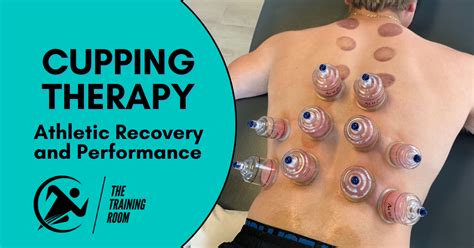 Cupping Therapy Does It Hurt