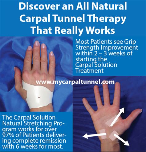 Curing Carpal Tunnel Naturally