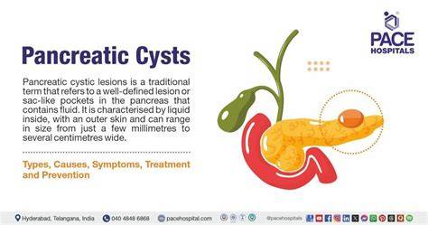 Cyst In The Pancreas Symptoms
