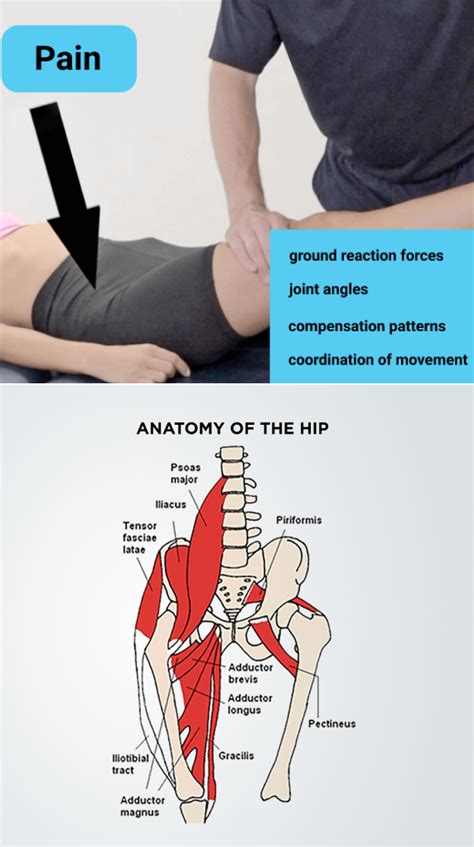 Damaged Hip Flexor