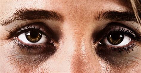 Dark Shadows Under Eyes