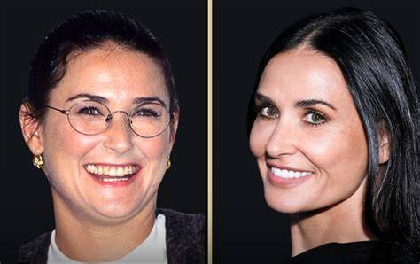 Demi Moore Face Surgery