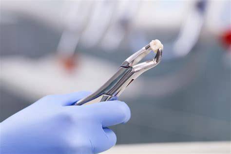 Dentistry Tooth Extraction
