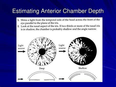 Depth Of Anterior Chamber Of Eye