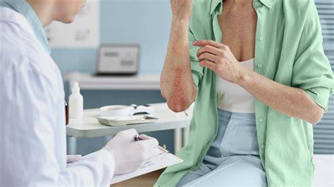 Dermatologist For Psoriasis