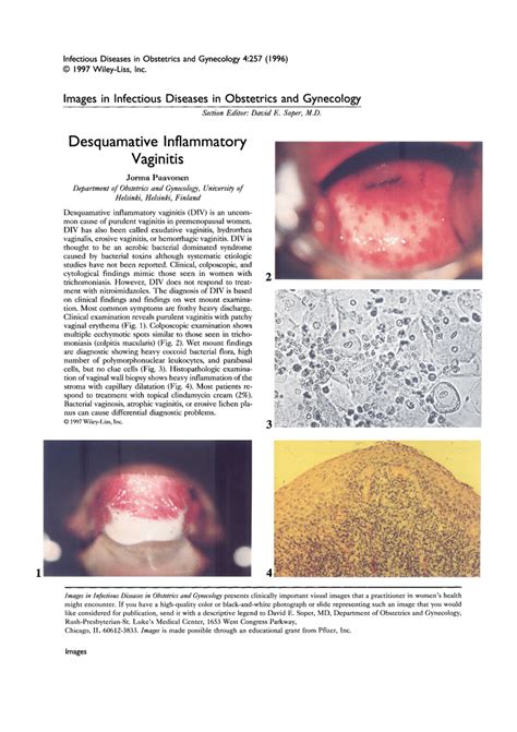 Desquamative Inflammatory Vaginitis
