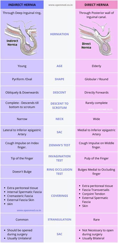 Direct Vs Indirect Hernia