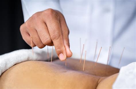 Disadvantages Of Acupuncture