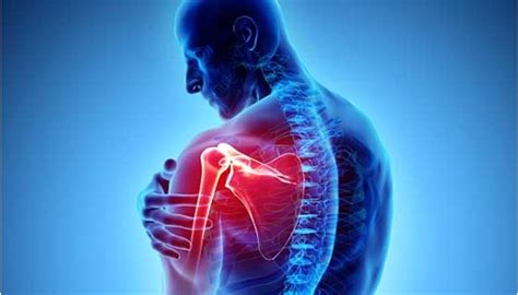 Discomfort In Shoulder And Arm