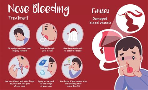 Do Stress Cause Nose Bleeding