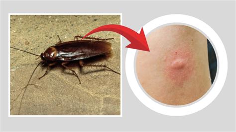 Do You Cockroaches Bite