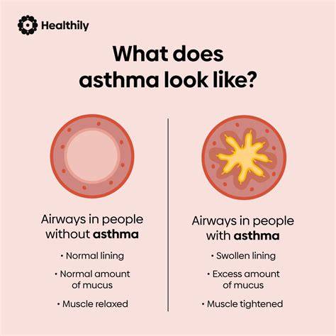 Does Asthma Go Away