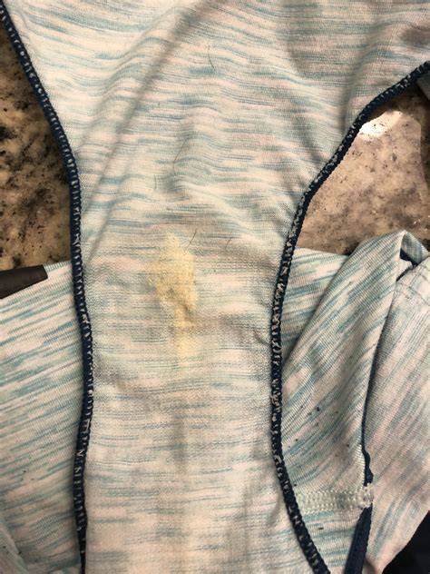Does Discharge Stain Underwear
