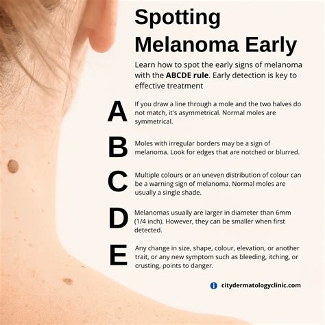 Does Melanoma Itch