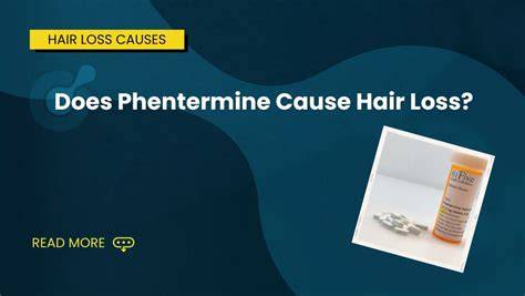 Does Phentermine Cause Hair Loss