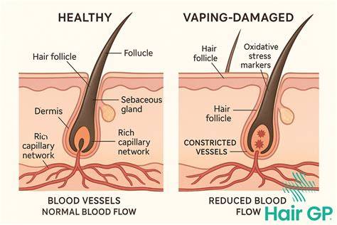 Does Vaping Cause Hair Loss