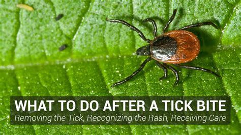 Dog Tick Bite Treatment