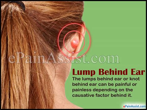 Ear Pain Lump Behind Ear
