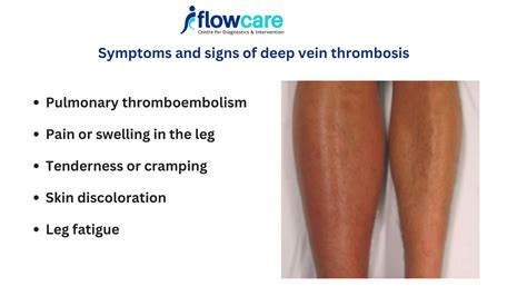 Early Stage Dvt Symptoms Leg