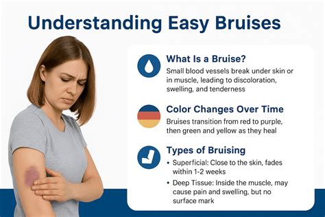 Easy Bruising Meaning