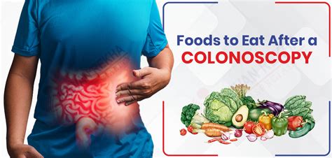 Eating After Colonoscopy