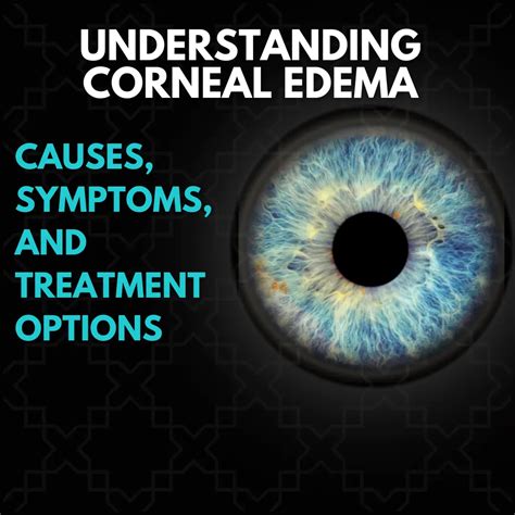 Edema Eye Disease