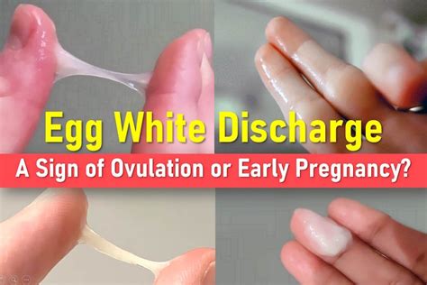 Egg White Discharge
