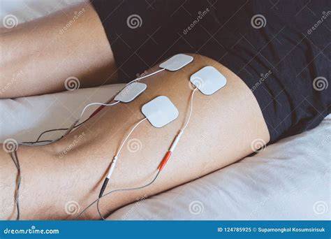 Electric Stimulation Therapy