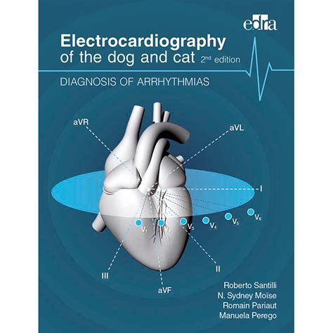 Electrocardiography Of Arrhythmias