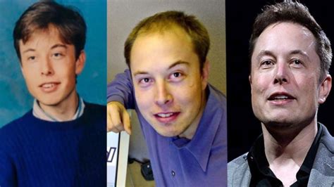 Elon Musk Before Face Surgery