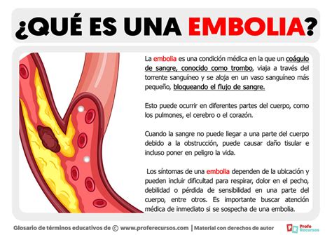 Embolia En Ingles