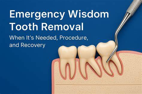 Emergency Removal Of Wisdom Tooth