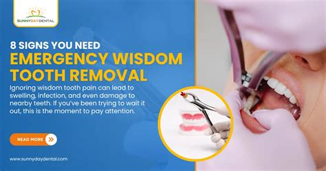 Emergency Wisdom Tooth Removal