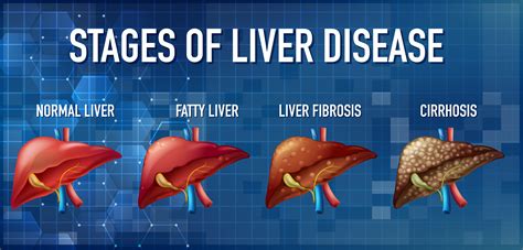 Endstage Liver Disease Death Process