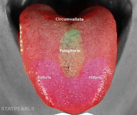 Enlarged Taste Buds Tongue