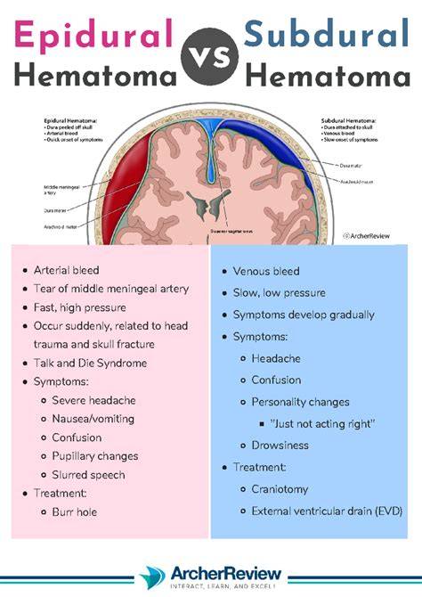Epidural Hematoma Vs Subdural Hematoma