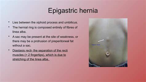 Epigastric Hernias Surgery