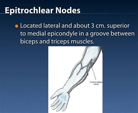 Epitrochlear Lymph Node