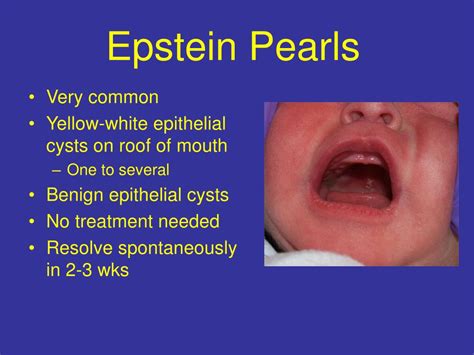 Epstein Pearls Baby