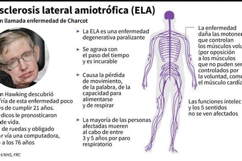 Esclerosis Lateral Amiotrófica