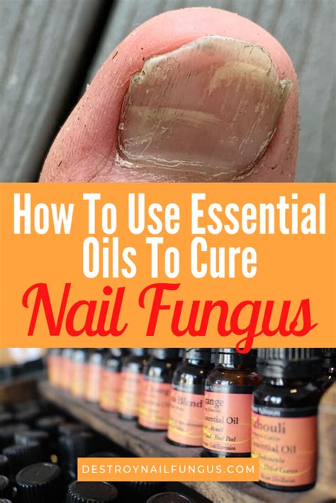 Essential Oils And Nail Fungus